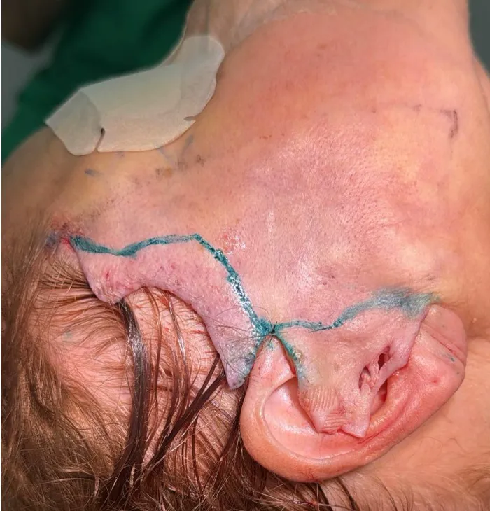 Marcação de cirurgia facial no IDC