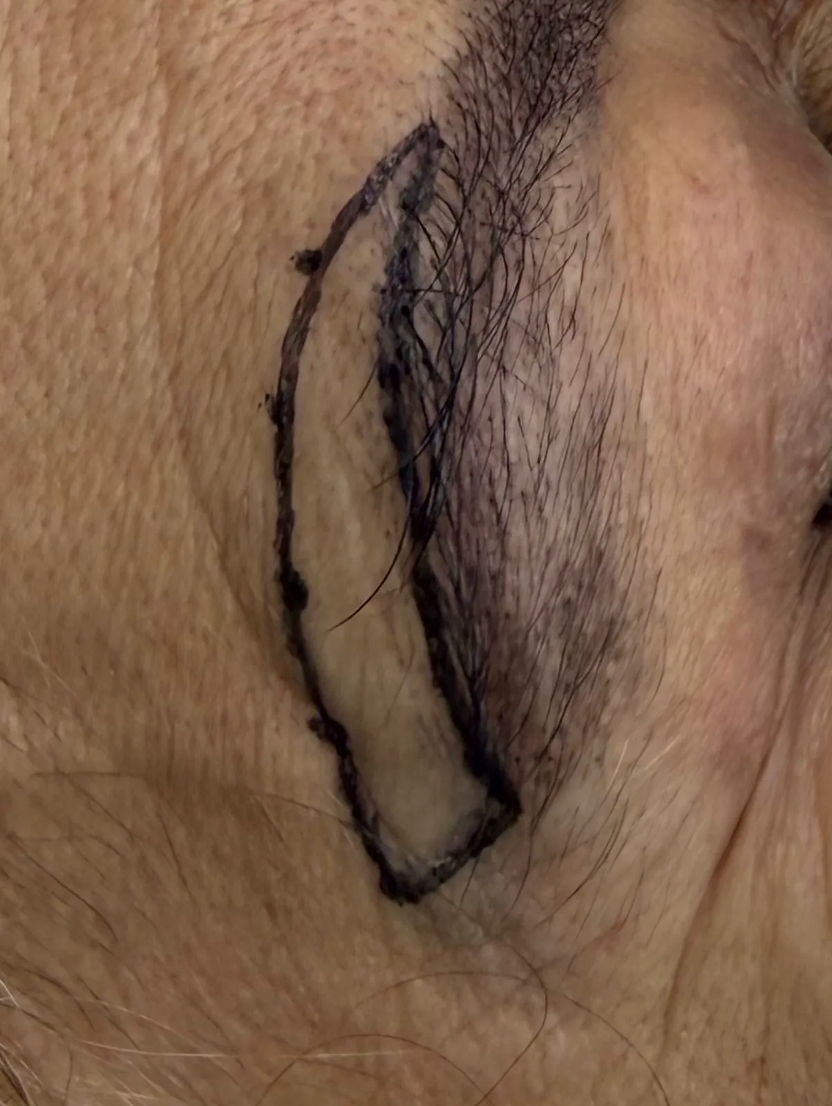 Detalhe de técnica facial